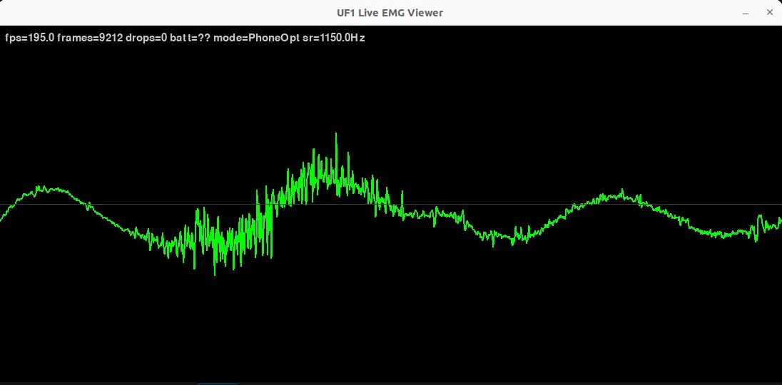 UF1 Live EMG Viewer showing real-time signal